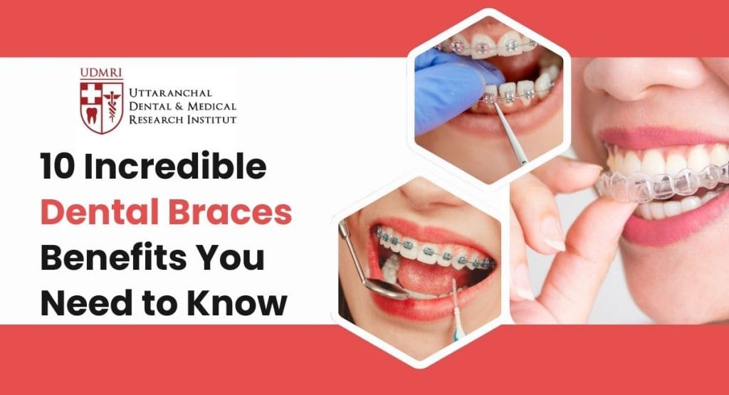 dental brace benefits